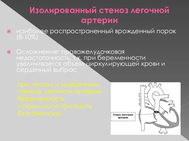 Изолированный стеноз легочной артерии наиболее распространенный врожденный порок (8-10%) Осложнение: правожелудочковая