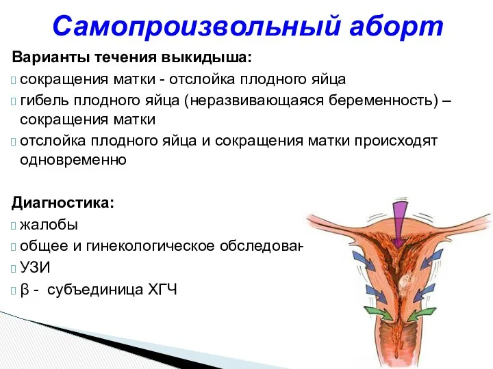 Варианты течения выкидыша: сокращения матки - отслойка плодного яйца гибель плодного