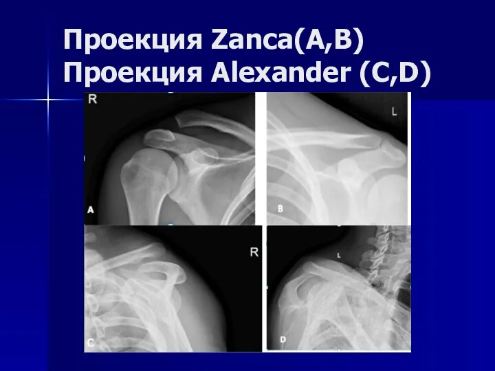 Проекция Zanca(A,B) Проекция Alexander (C,D)