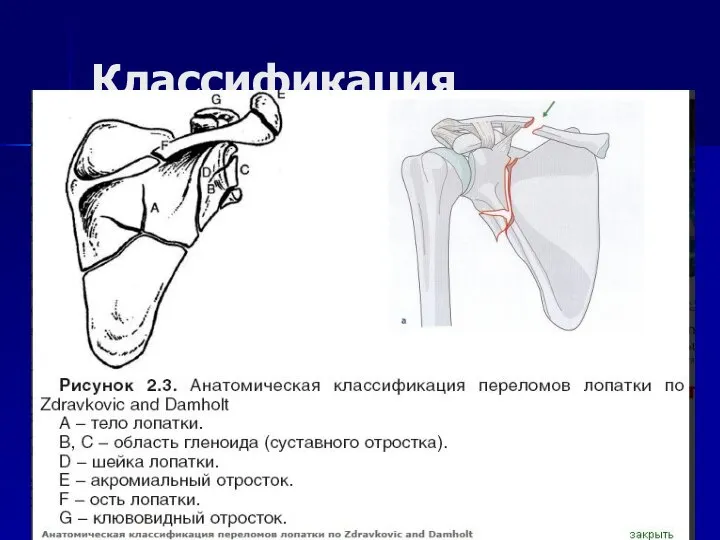 Классификация