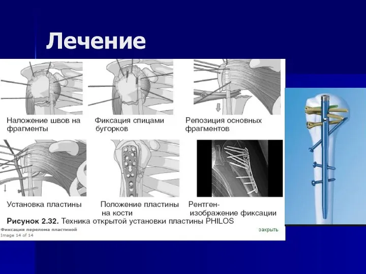 Лечение