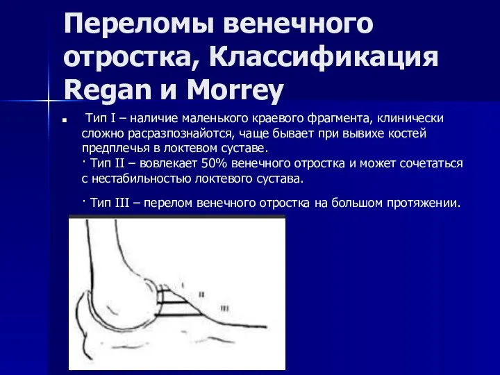 Переломы венечного отростка, Классификация Regan и Morrey Tип I – наличие