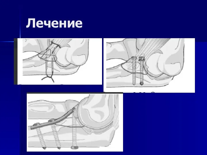 Лечение