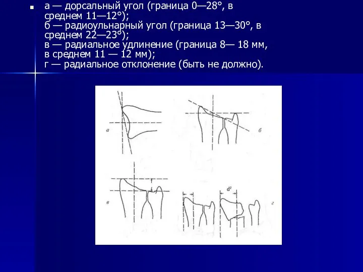 а — дорсальный угол (граница 0—28°, в среднем 11—12°); б —