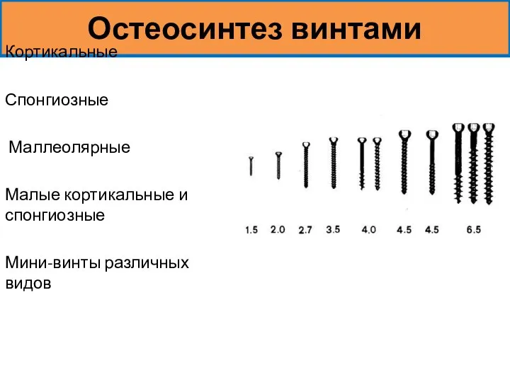 Остеосинтез винтами Кортикальные Спонгиозные Маллеолярные Малые кортикальные и спонгиозные Мини-винты различных видов