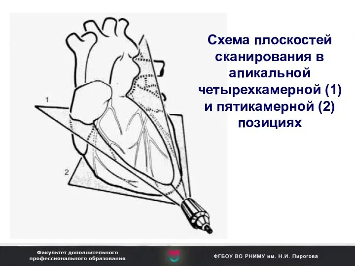 Схема плоскостей сканирования в апикальной четырехкамерной (1) и пятикамерной (2) позициях