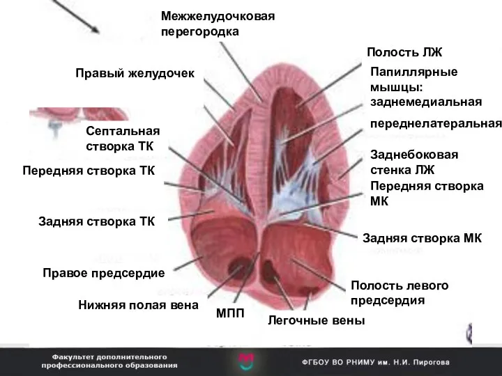 Межжелудочковая перегородка Полость ЛЖ Папиллярные мышцы: заднемедиальная переднелатеральная Заднебоковая стенка ЛЖ