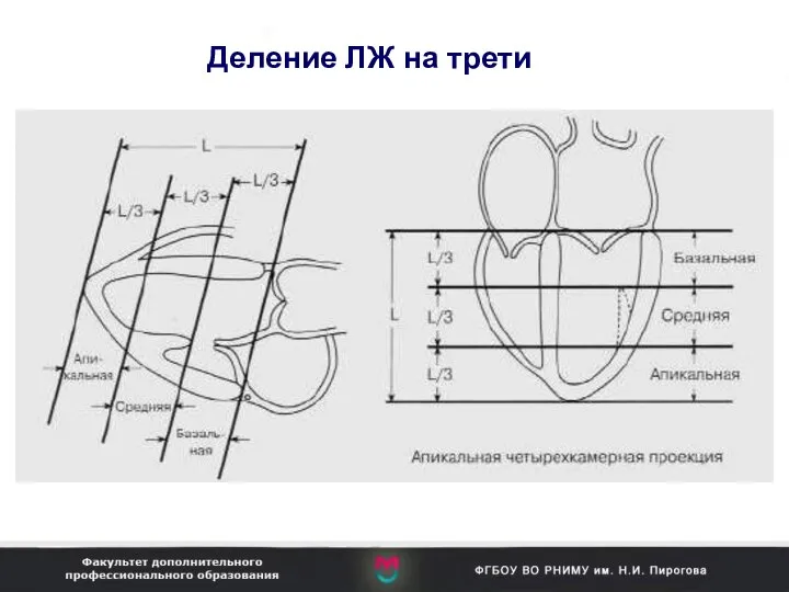 Деление ЛЖ на трети