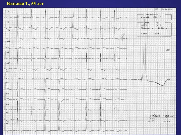Больная Т., 55 лет
