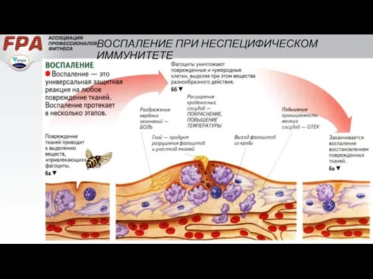 ВОСПАЛЕНИЕ ПРИ НЕСПЕЦИФИЧЕСКОМ ИММУНИТЕТЕ