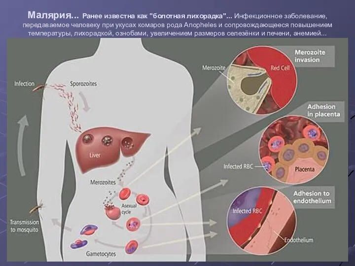 Малярия... Ранее известна как "болотная лихорадка"... Инфекционное заболевание, передаваемое человеку при