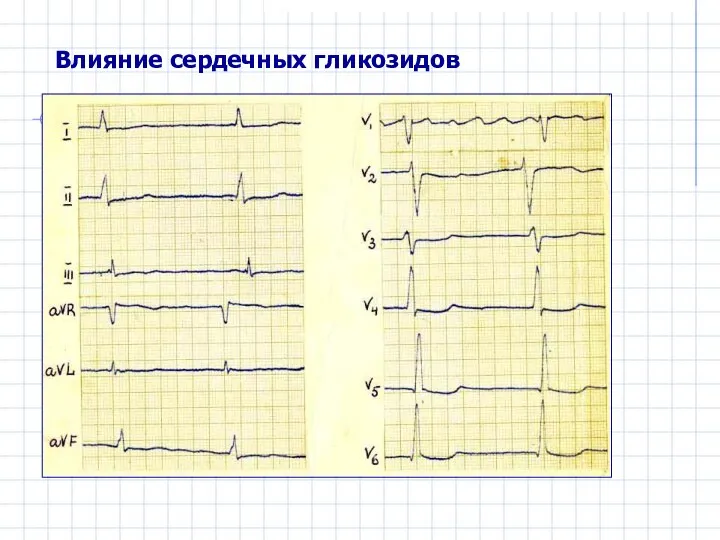 Влияние сердечных гликозидов