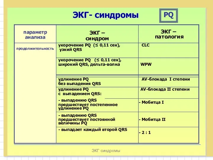 ЭКГ синдромы ЭКГ- синдромы PQ