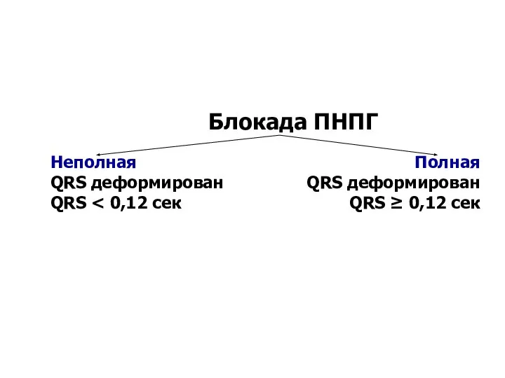 Неполная QRS деформирован QRS Полная QRS деформирован QRS ≥ 0,12 сек Блокада ПНПГ