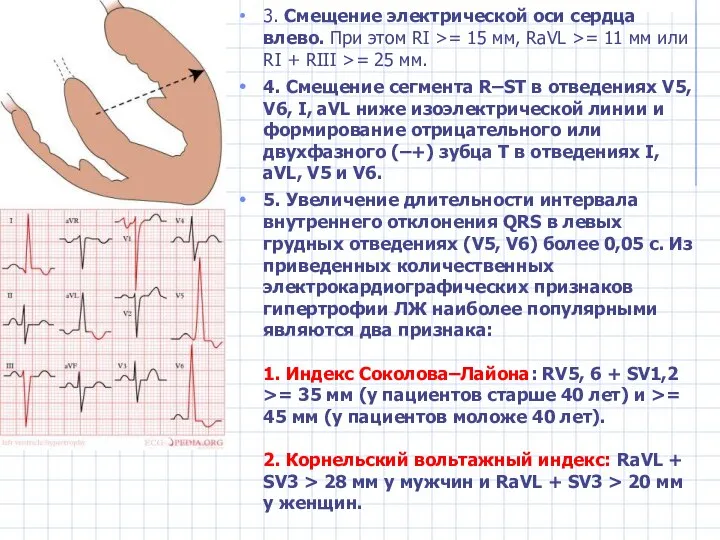 3. Смещение электрической оси сердца влево. При этом RI >= 15