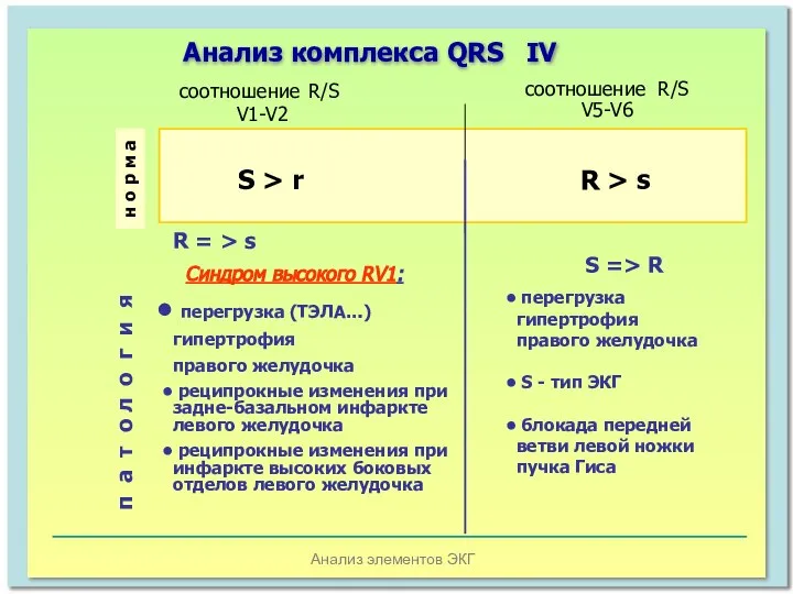 Анализ элементов ЭКГ Анализ комплекса QRS IV S > r R