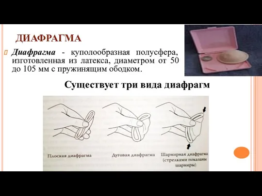 ДИАФРАГМА Диафрагма - куполообразная полусфера, изготовленная из латекса, диаметром от 50