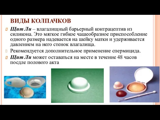 ВИДЫ КОЛПАЧКОВ Щит Ли – влагалищный барьерный контрацептив из силикона. Это