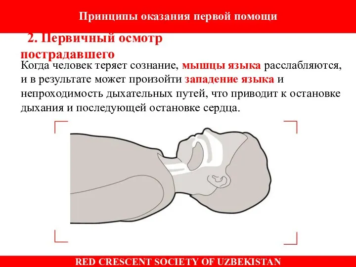 Когда человек теряет сознание, мышцы языка расслабляются, и в результате может