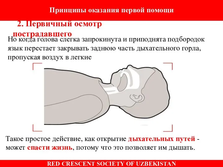 Такое простое действие, как открытие дыхательных путей - может спасти жизнь,