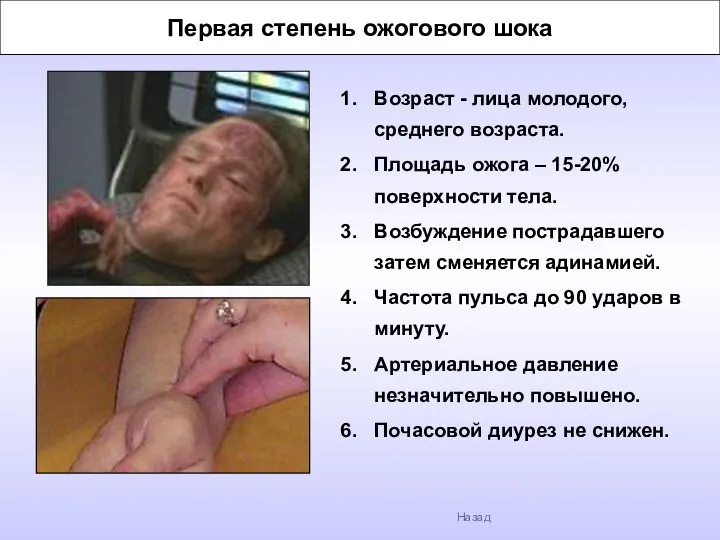 Первая степень ожогового шока Возраст - лица молодого, среднего возраста. Площадь