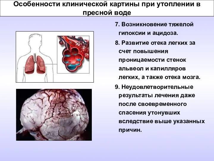 Особенности клинической картины при утоплении в пресной воде 7. Возникновение тяжелой
