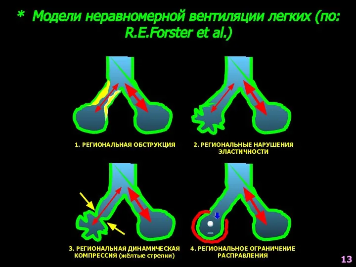 * Модели неравномерной вентиляции легких (по: R.E.Forster et al.) 1. РЕГИОНАЛЬНАЯ