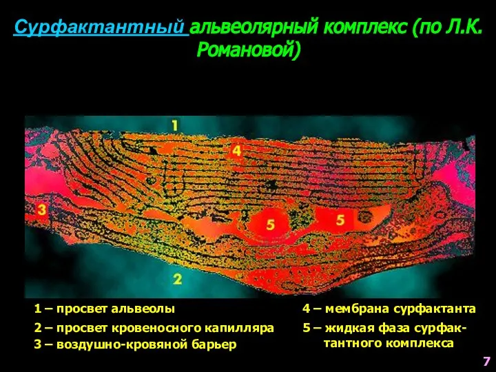 Сурфактантный альвеолярный комплекс (по Л.К.Романовой) 1 – просвет альвеолы 2 –