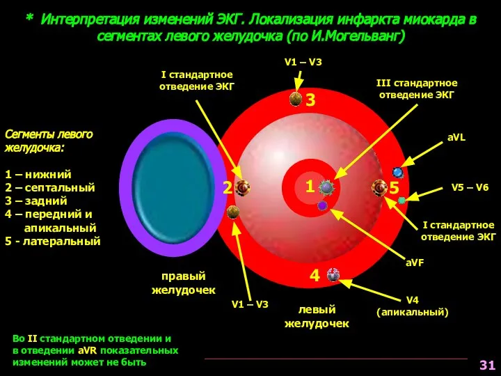 * Интерпретация изменений ЭКГ. Локализация инфаркта миокарда в сегментах левого желудочка