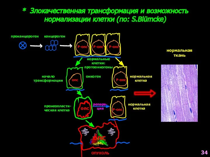 * Злокачественная трансформация и возможность нормализации клетки (по: S.Blümcke) Р-onc Р-onc