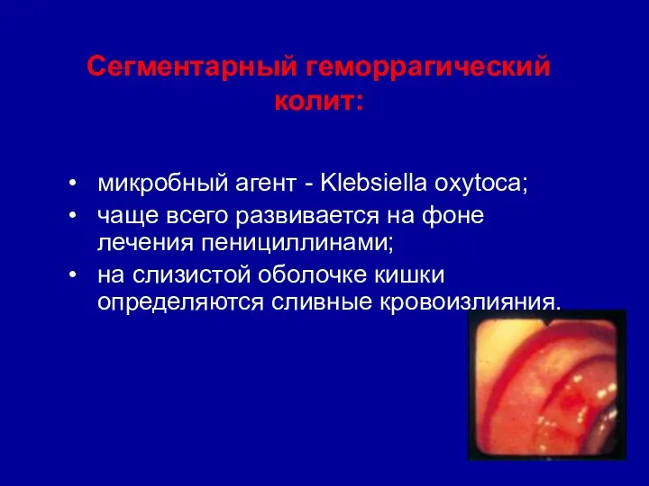 Сегментарный геморрагический колит: микробный агент - Klebsiella oxytoca; чаще всего развивается