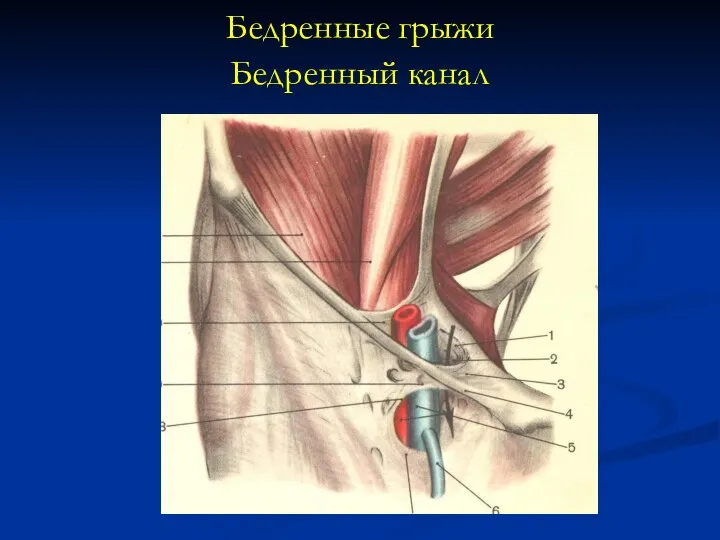 Бедренные грыжи Бедренный канал