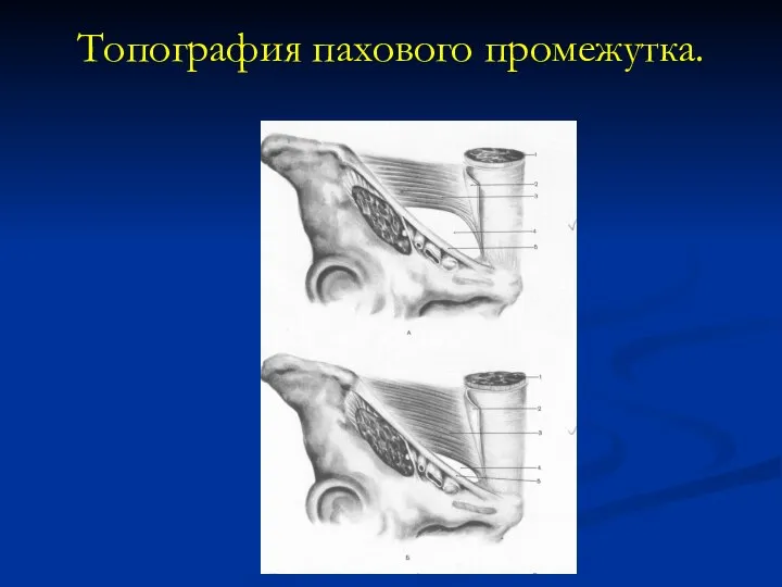 Топография пахового промежутка.