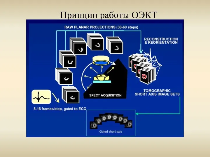 Принцип работы ОЭКТ