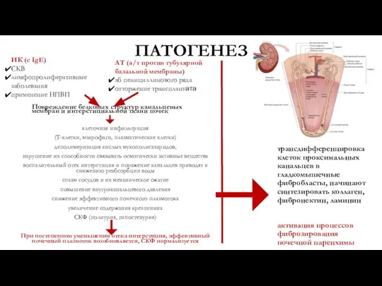 ПАТОГЕНЕЗ клеточная инфильтрация (Т-клетки, макрофаги, плазматические клетки) деполимеризация кислых мукополисахаридов, нарушение