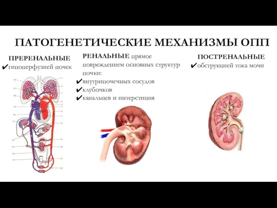 ПАТОГЕНЕТИЧЕСКИЕ МЕХАНИЗМЫ ОПП ПРЕРЕНАЛЬНЫЕ гипоперфузией почек РЕНАЛЬНЫЕ прямое повреждением основных структур