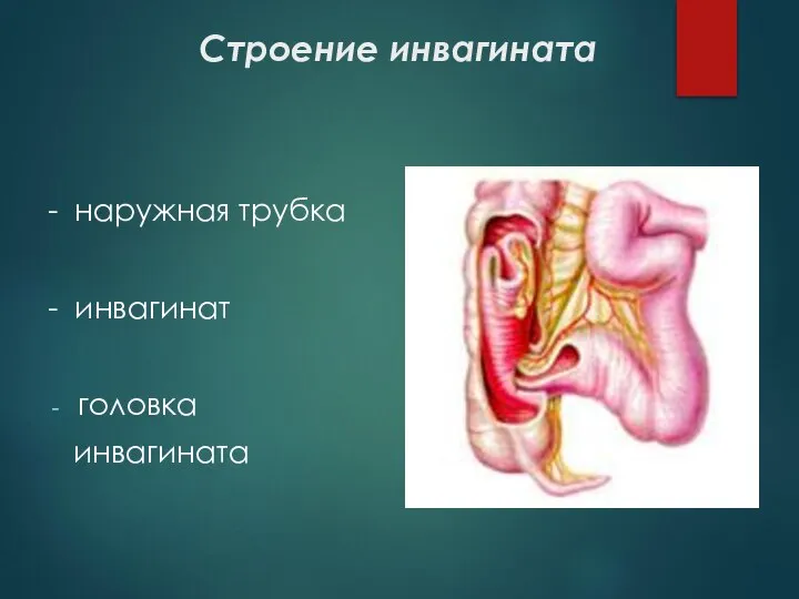 Строение инвагината - наружная трубка - инвагинат головка инвагината