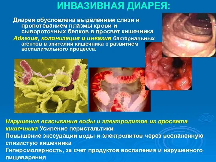 ИНВАЗИВНАЯ ДИАРЕЯ: Диарея обусловлена выделением слизи и пропотеванием плазмы крови и