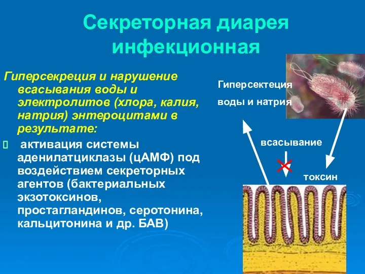 Секреторная диарея инфекционная Гиперсекреция и нарушение всасывания воды и электролитов (хлора,