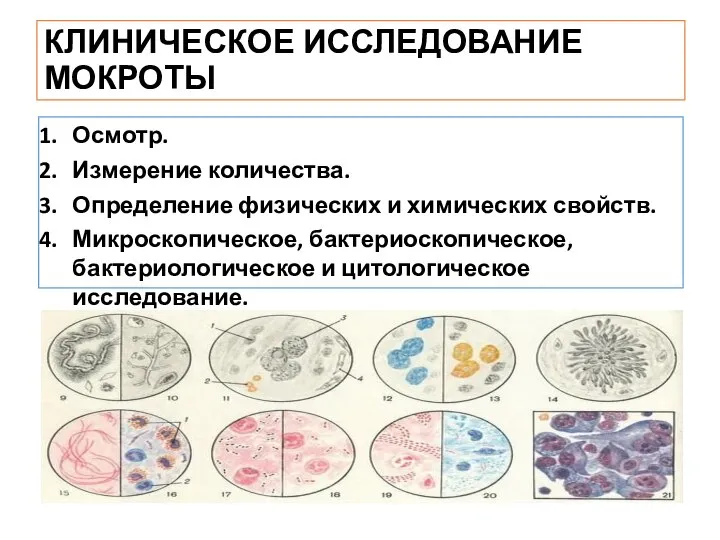 КЛИНИЧЕСКОЕ ИССЛЕДОВАНИЕ МОКРОТЫ Осмотр. Измерение количества. Определение физических и химических свойств.