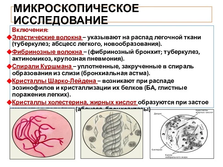 МИКРОСКОПИЧЕСКОЕ ИССЛЕДОВАНИЕ Включения: Эластические волокна – указывают на распад легочной ткани