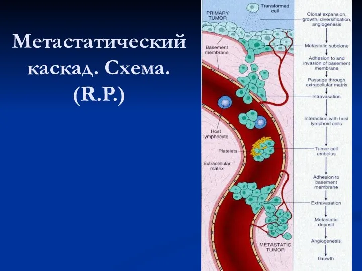 Метастатический каскад. Схема. (R.P.)