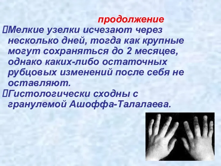 продолжение Мелкие узелки исчезают через несколько дней, тогда как крупные могут