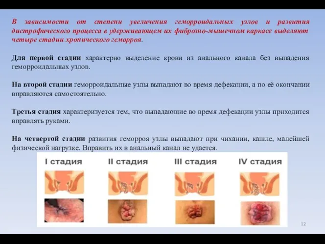 В зависимости от степени увеличения геморроидальных узлов и развития дистрофического процесса