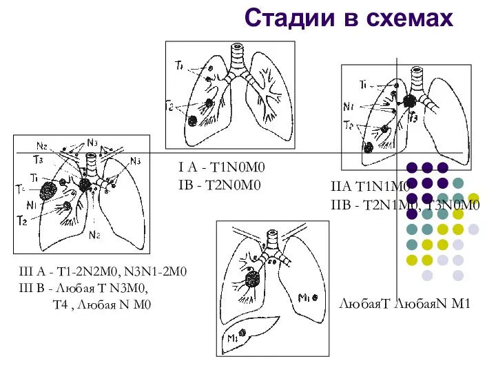 I A - T1N0M0 IB - T2N0M0 IIA T1N1M0 IIB -