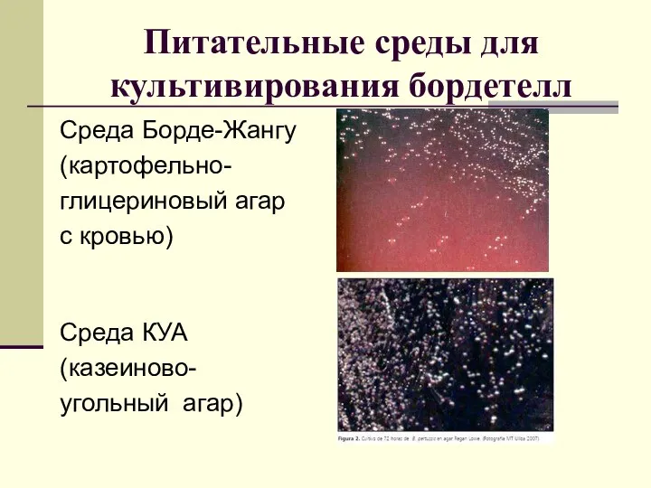 Питательные среды для культивирования бордетелл Среда Борде-Жангу (картофельно- глицериновый агар с