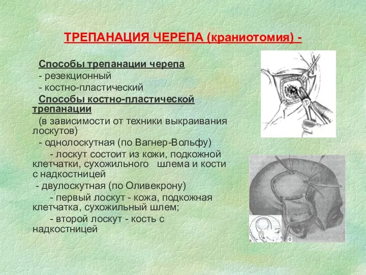 ТРЕПАНАЦИЯ ЧЕРЕПА (краниотомия) - Способы трепанации черепа - резекционный - костно-пластический