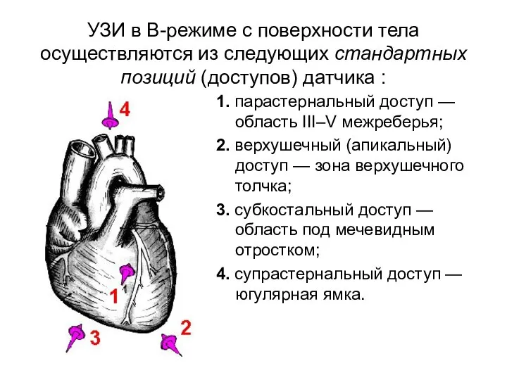 УЗИ в В-режиме с поверхности тела осуществляются из следующих стандартных позиций