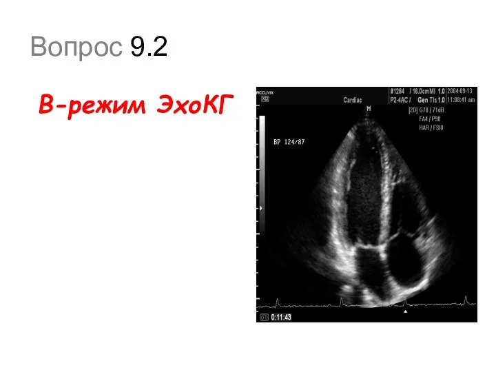 Вопрос 9.2 В-режим ЭхоКГ