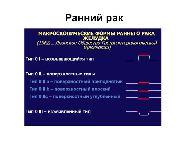 Ранний рак